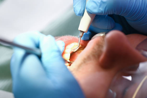 Best Mobile Emergency Dentist in Forest, VA