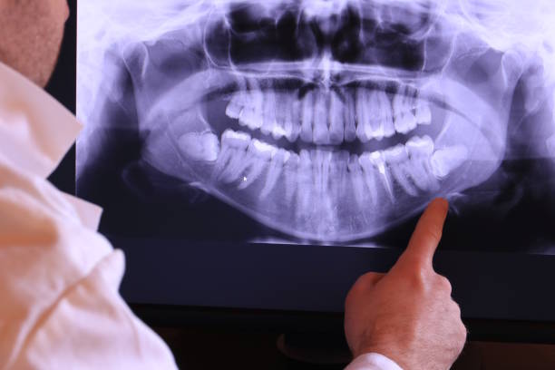 Best Emergency Dentist for Lost Fillings or Crowns in Forest, VA