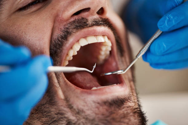 Best Broken or Cracked Tooth Emergency Dentist in Forest, VA