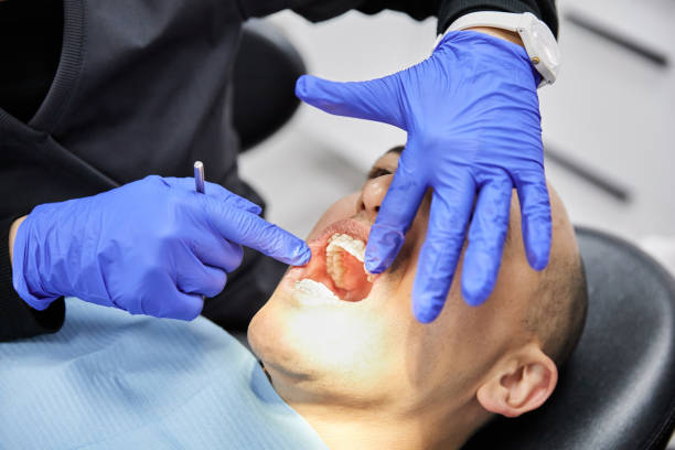 Best Emergency Root Canal Treatment in Forest, VA