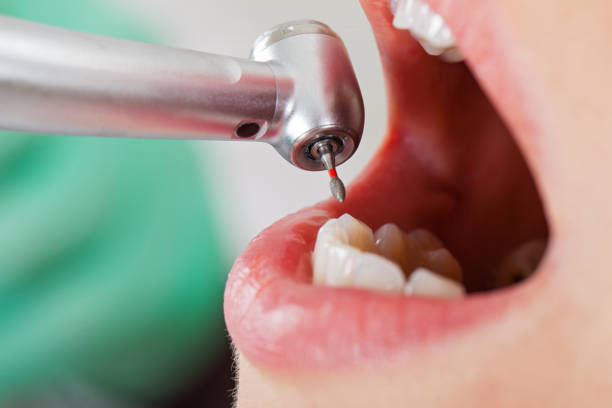 Best Urgent Dental Care for Toothache in Forest, VA
